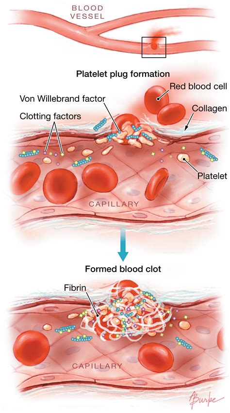 The Potential Health Concerns Associated with Visions of Expectorating Coagulated Sanguineous Collections