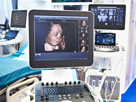 The Power of Ultrasound: Exploring the Technology Behind Fetal Imaging