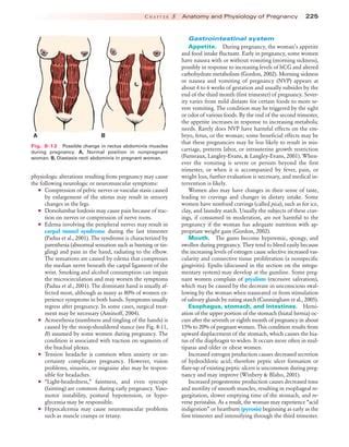 The Prevalent Phenomenon of Unconscious Gestation