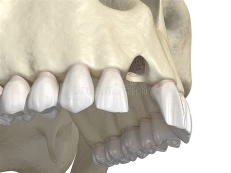 The Psychological Interpretation of Lower Incisors in Dreams