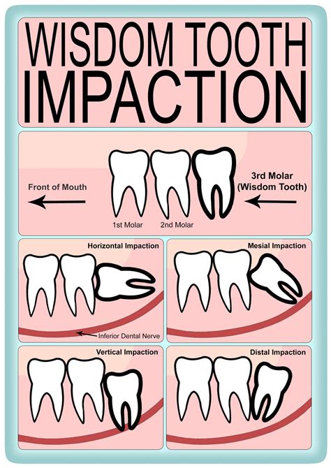 The Relationship Between Dreams About Wisdom Teeth and Physical Wellbeing