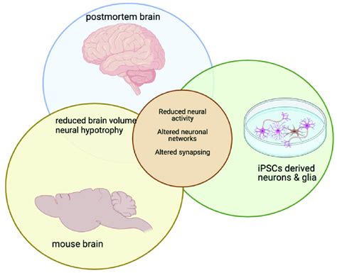 The Role of Brain Activity in Post-mortem Journey through Dreams