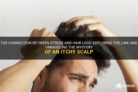 The Science Behind Flaky Scalp: Unraveling the Mystery