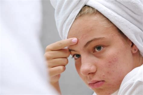 The Scientific Principles Behind Successful Pimple Elimination