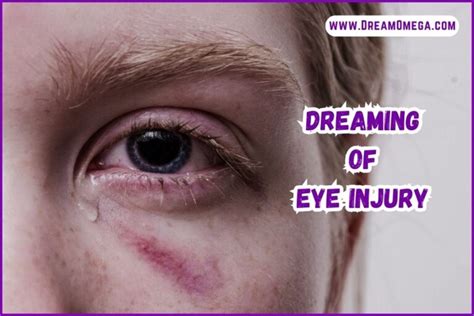 The Significance of Dreaming about a Beloved Individual Experiencing Injury