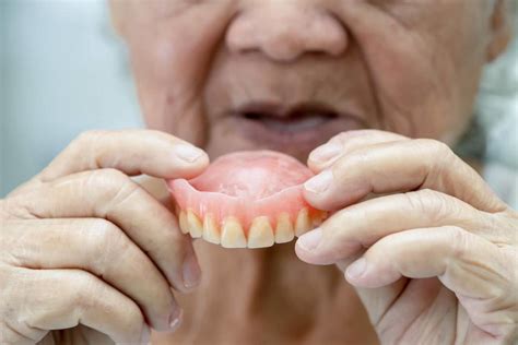 The Societal Perspectives on Dreaming about Wearing Dentures