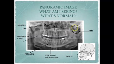 The Symbolic Interpretation of Ivory Substance in Oral Cavity