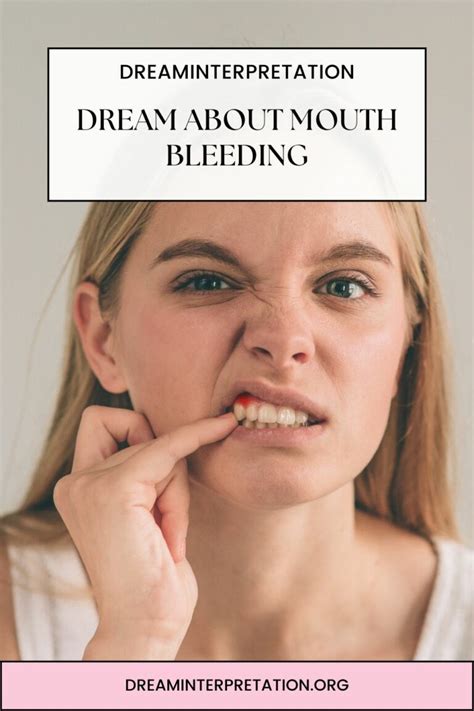 The Symbolic Meaning of Mouth Bleeding in Dreams