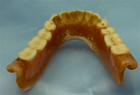 The Symbolic Meanings of Wobbly Stained Dentures