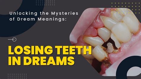 The Symbolic Significance of Losing a Tooth Crown in Dreams