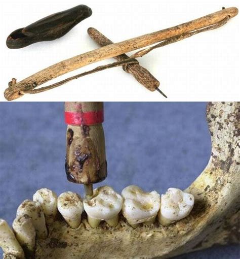 The Symbolic Significance of Wooden Teeth in Ancient Civilizations