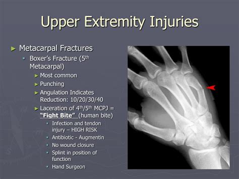 The Symbolism of an Injured Upper Limb