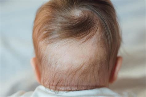 The Unexpected Reasons for Infant Hair Thinning