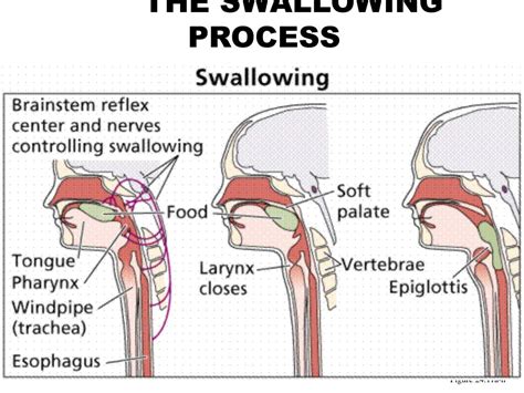 The Unexpected Triggers Behind Experiencing Regurgitation Sensations in the Oral Cavity