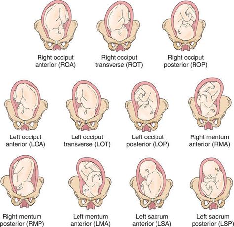 The Various Types of Fetal Movements and Their Significance