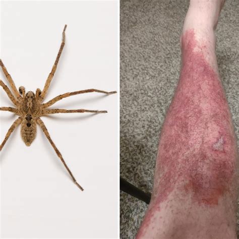 The Venomous Bite: Understanding the Elusive Spider's Perilous Manner