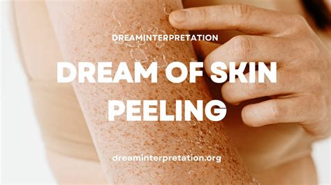 Tips for Analyzing and Interpreting Dreams Related to Peeling Skin