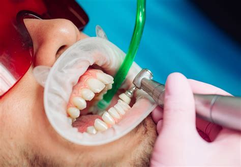 Tips for Analyzing and Understanding Teeth-Cleaning Visions