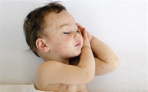 Tips for Analyzing and Understanding Your Dreams of Infant Insect Bites