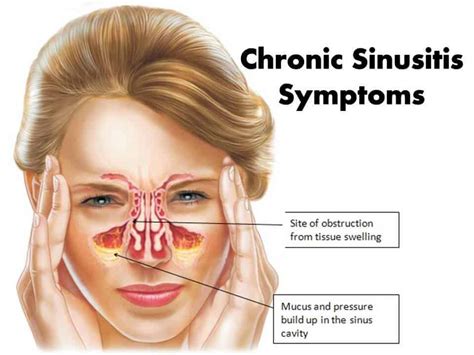 Tips for Decoding and Examining Dreams Related to Nasal Debris