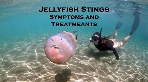 Tips for Decoding and Understanding Dreams About Getting Stung by Jellyfish