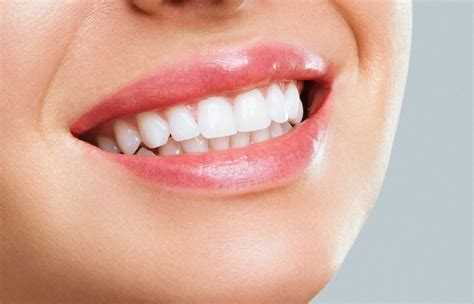 Traditional Teeth Whitening Methods