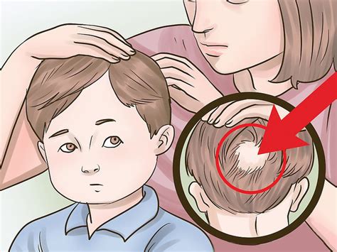 Treating Hair Loss in Children: Medical Interventions