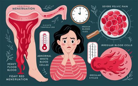 Treatment Options for Excessive Menstrual Flow: Addressing the Issue through Medications and Surgeries