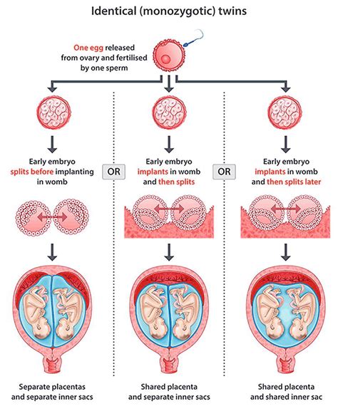 Types of Multiple Pregnancies: From Pairings to Quintet