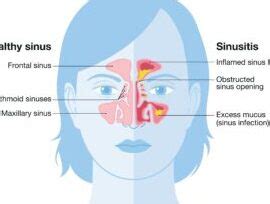 Uncovering the Symbolism: Understanding the Significance of Nasal Follicles