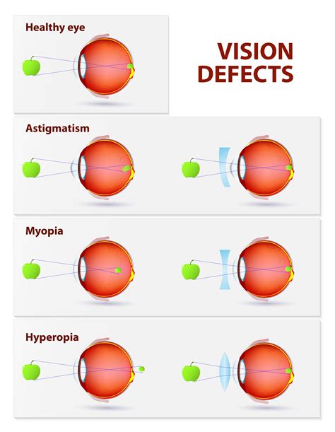 Understanding Common Vision Issues and Their Surgical Solutions