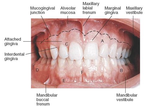 Understanding Dental Well-being in Dreams: Deteriorating Gingiva as a Reflection of Self-Nurturing