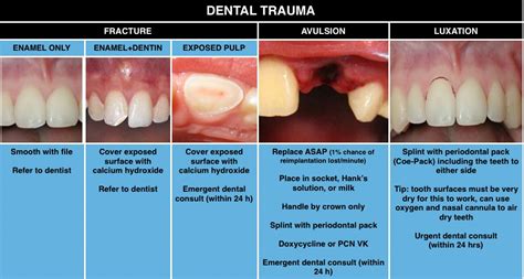 Understanding Dreams of Oral Trauma: A Psychological Perspective