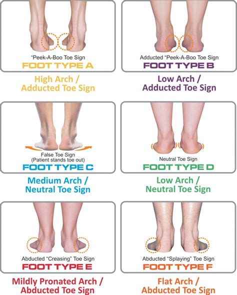 Understanding Your Foot Type: Taking a Step Towards Discovering the Ideal Footwear