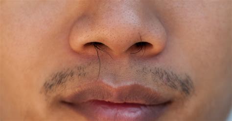 Understanding and Interpreting Dreams about Hair Growing On the Nose