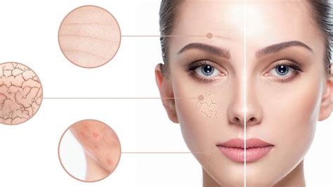 Understanding the Causes of Large Pores and Clogged Skin