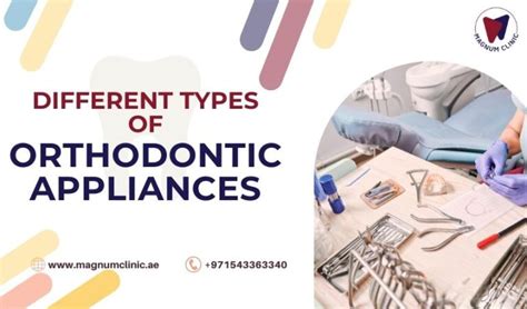 Understanding the Enchantment of Orthodontic Appliances