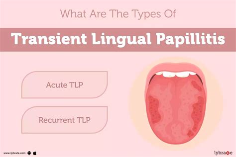 Understanding the Enigma of Lingual Inflammation in Fantasies