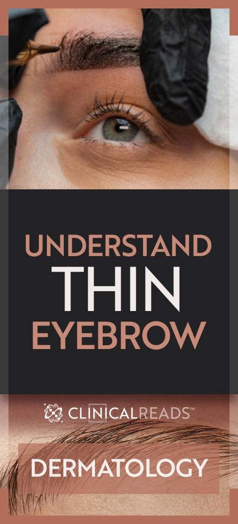 Understanding the Factors Behind Thinning Eyebrows