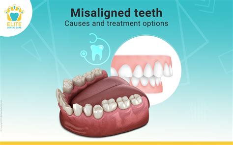 Understanding the Fascination of Dental Misalignment in Dreams