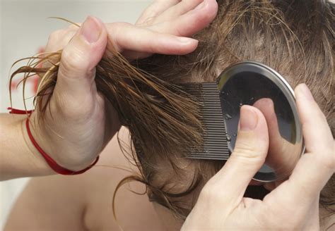 Understanding the Frustration: Key Facts About Head Lice