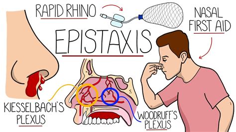 Understanding the Physiology behind Epistaxis: A Deeper Dive