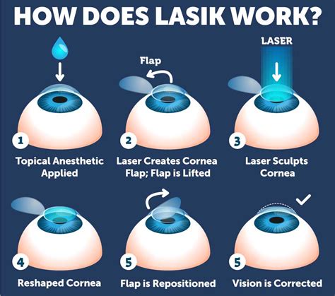 Understanding the Process and Recovery of Ocular Surgery: A Comprehensive Guide