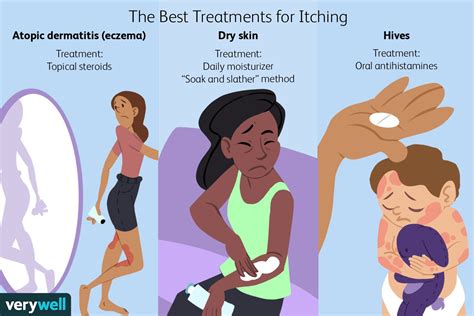 Understanding the Sensation of Itching: Causes and Remedies