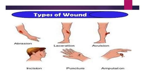 Understanding the Symbolism of Wounds on the Right Hand