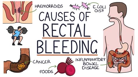 Understanding the emotional impact of dreams featuring blood in stool