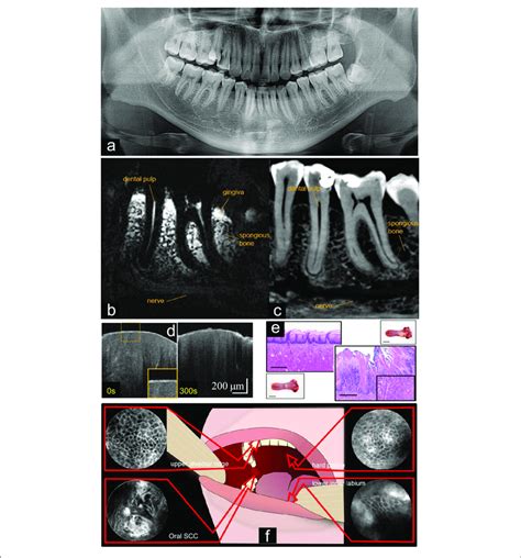 Unlocking the Potential of Dreams Featuring Tissue in the Oral Cavity: Techniques for Personal Development