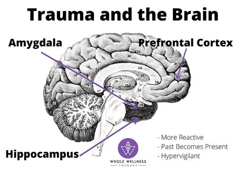 Unpacking the Emotional Impact of Brain Trauma Visions