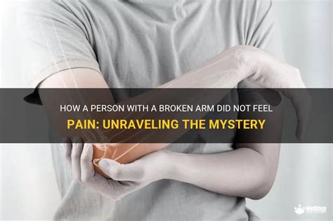 Unraveling the Interpretations of Dreaming about an Injured Arm