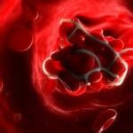 Unraveling the Mysterious Interpretation of Dreaming about Massive Blood Clots